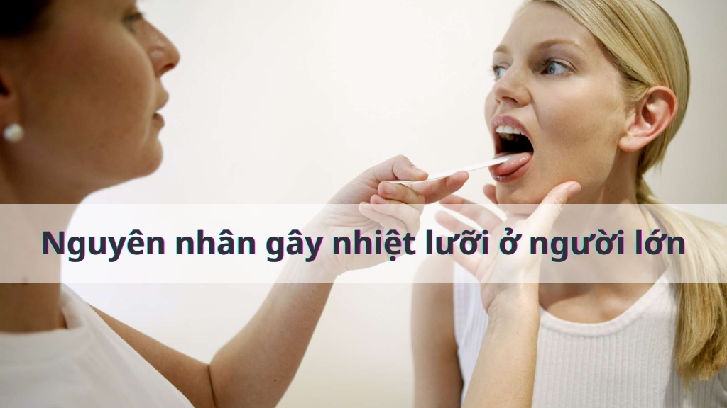 Nguyên nhân gây nhiệt lưỡi ở người lớn