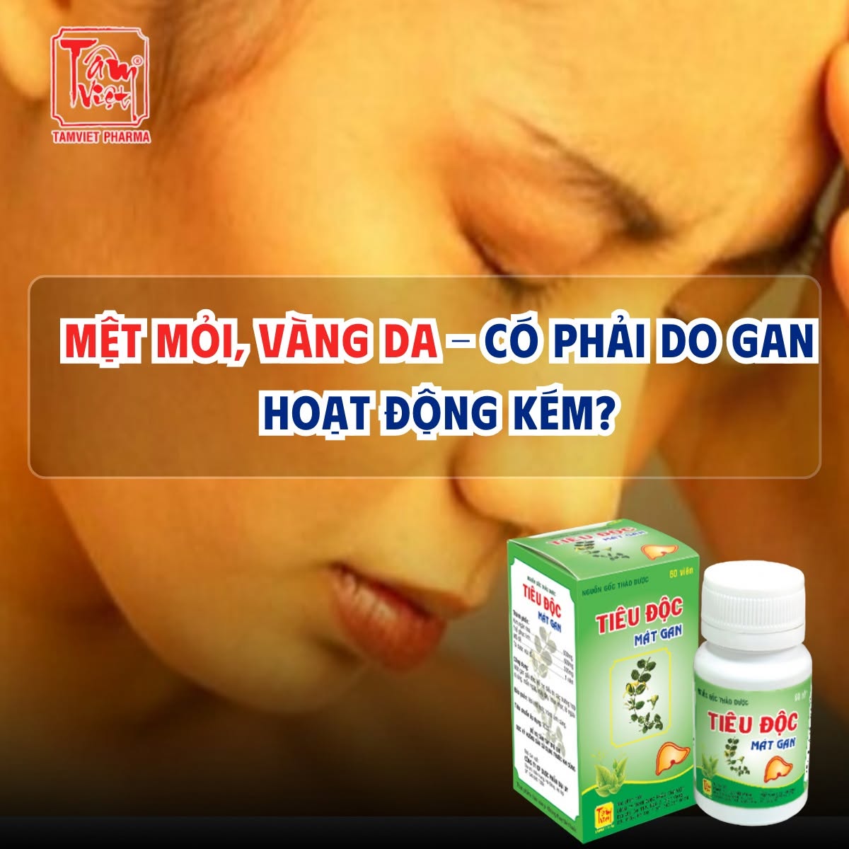 MỆT MỎI, VÀNG DA – DẤU HIỆU CẢNH BÁO GAN ĐANG "LÊN TIẾNG"